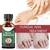 Anti fungo Nail Repair Essence Soro, Unhas Tratamento Cuidados, Remoção Pé Pa - Casa Xique Xique