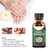 Anti fungo Nail Repair Essence Soro, Unhas Tratamento Cuidados, Remoção Pé Pa - loja online