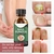 Imagem do Anti fungo Nail Repair Essence Soro, Unhas Tratamento Cuidados, Remoção Pé Pa