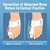 Corrector ortopétalas hallux valgus na internet