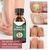 Anti fungo Nail Repair Essence Soro, Unhas Tratamento Cuidados, Remoção Pé Pa