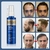 Imagem do Anti perda de cabelo rebrota essência crescimento do cabelo soro spray cabelo r