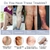 Creme eficaz para alívio das veias varicosas, eliminar a vasculite, flebite, ar - ROSA DE SAROM