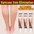 Creme eficaz para alívio das veias varicosas, eliminar a vasculite, flebite, ar - loja online