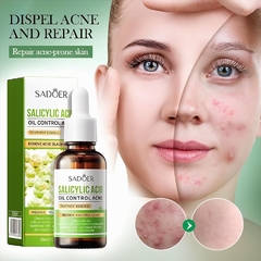 Sérum de Ácido Salicilico Oil Control Sadoer - comprar en línea