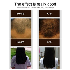 Purc-Spray para el crecimiento del cabello, esencia de Jengibre Natural, extract - productoschidos