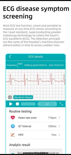 2025 Nuevo reloj inteligente calibrado medicamente. - Smart Watch_cmg