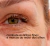 Lifting eye solution - FormulArte