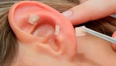 Auriculoterapia - comprar online