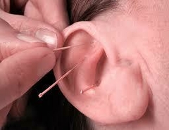 Auriculoterapia en internet