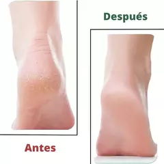 Imagen de Lima para Pies saca callos. Pedicuria Manual