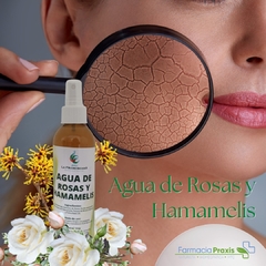 Agua de Rosas y Hamamelis