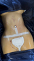 Abdominoplastía - comprar online
