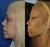 Lifting Facial - comprar online