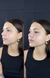 Contorno Mandibular en internet