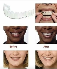 CARILLAS DENTALES, PRODUCTO ESTÉTICO - GRAN BAZAR
