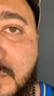 Microdermal - juliartera piercings