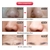 Máscara Facial LED Light na internet