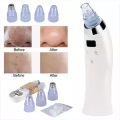 EXTRACTOR PUNTOS NEGROS - comprar online