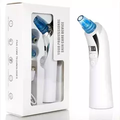 EXTRACTOR PUNTOS NEGROS