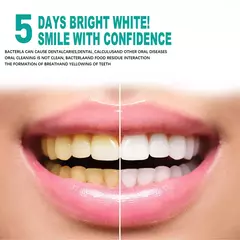 Creme dental removedor de marchas - comprar online