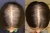 Cápsula HAIR na internet