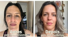 Sérum Prevenção - 10ml - comprar online