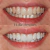 Blanqueador Dental Carbón Activado - comprar online