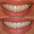 Blanqueador Dental Carbón Activado en internet