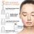 Removedor de Cravo Facial na internet