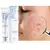 Creme Facial Antiacne na internet