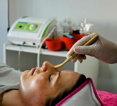 Peeling Químico