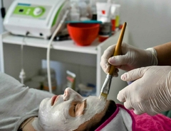 Limpieza Facial c/ Microdermoabración en internet