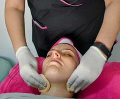 Limpieza Facial c/ Microdermoabración - tienda online