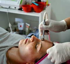 Imagen de Limpieza Facial c/ Microdermoabración