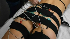 Electrodos