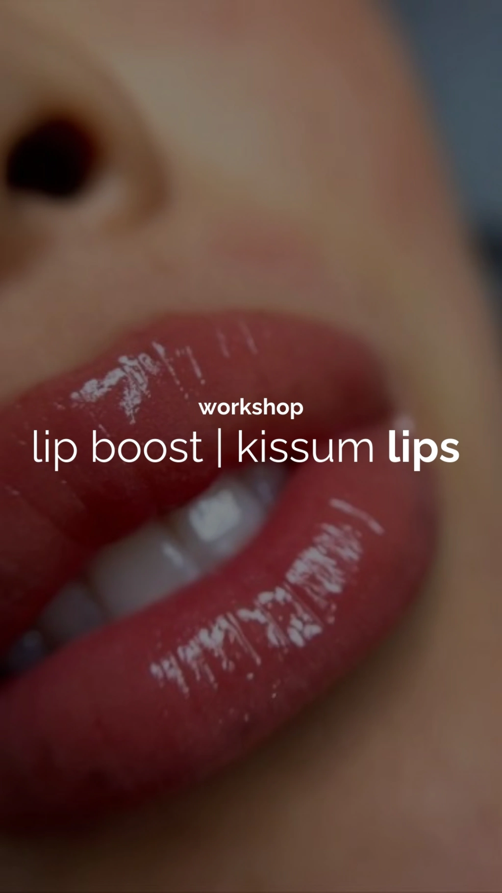 Lip boost y kissum lips + Dermaplaning + microneedling
