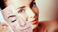 Banner de la categoría FACIALES