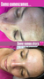 Pack 4 sesiones de Peeling - vm_skinlovers