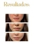 Micro Peel Espiculite Moistshield Ha en internet