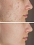 SKIN 1004 - Ampolla Facial Madagascar Centella Tea-Trica - tienda online