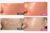 Medicube - Crema de Colágeno Collagen Jelly Cream - Keytin