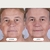 Máscara de Terapia de Luz LED CurrentBody Skin Serie 2 - Del Mundo