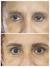 micropigmentacion de Cejas - Estetica Bella Love