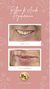 Hydra gloss para Labios - Estetica Bella Love