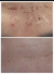 Fibroblastos Plasma Pen en internet