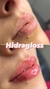 Hydra gloss para Labios