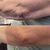 Fibroblastos Plasma Pen - comprar online