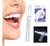 Lapiz Con Gel Blanqueador Dientes Instantaneo White Pen