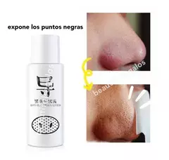 Removedor Extractor Puntos Negros Espinillas Con Loción en internet